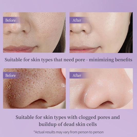 BEAUTNICE Peeling Gel - Gentle Exfoliator for Dead Skin Removal & Instant Skin Renewal