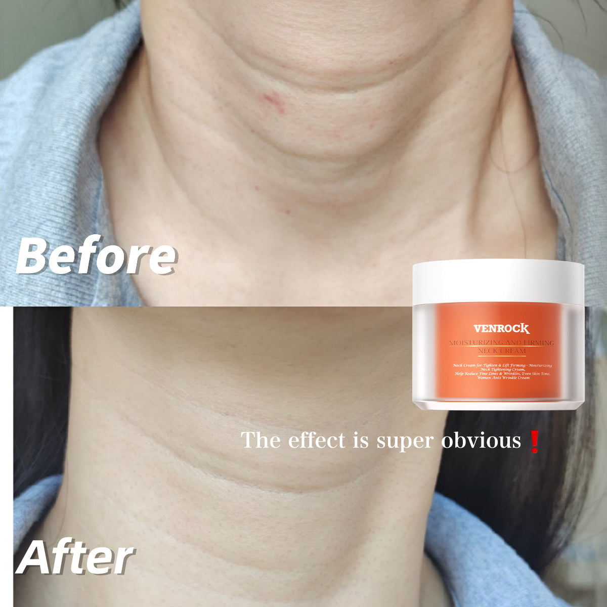 MOISTURIZING AND FIRMING NECK CREAM - Advanced Anti-Aging & Tightening Treatment for Neck and Décolletage