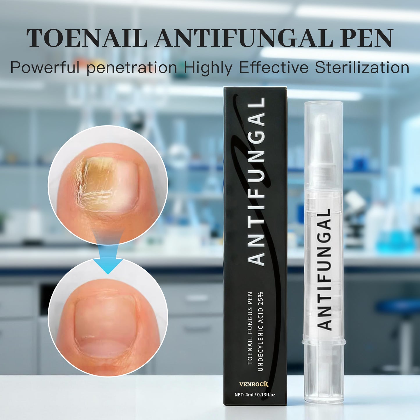 TOENAIL FUNGUS PEN - Advanced Antifungal Treatment & Nail Repair Solution for Clear, Healthy Nails