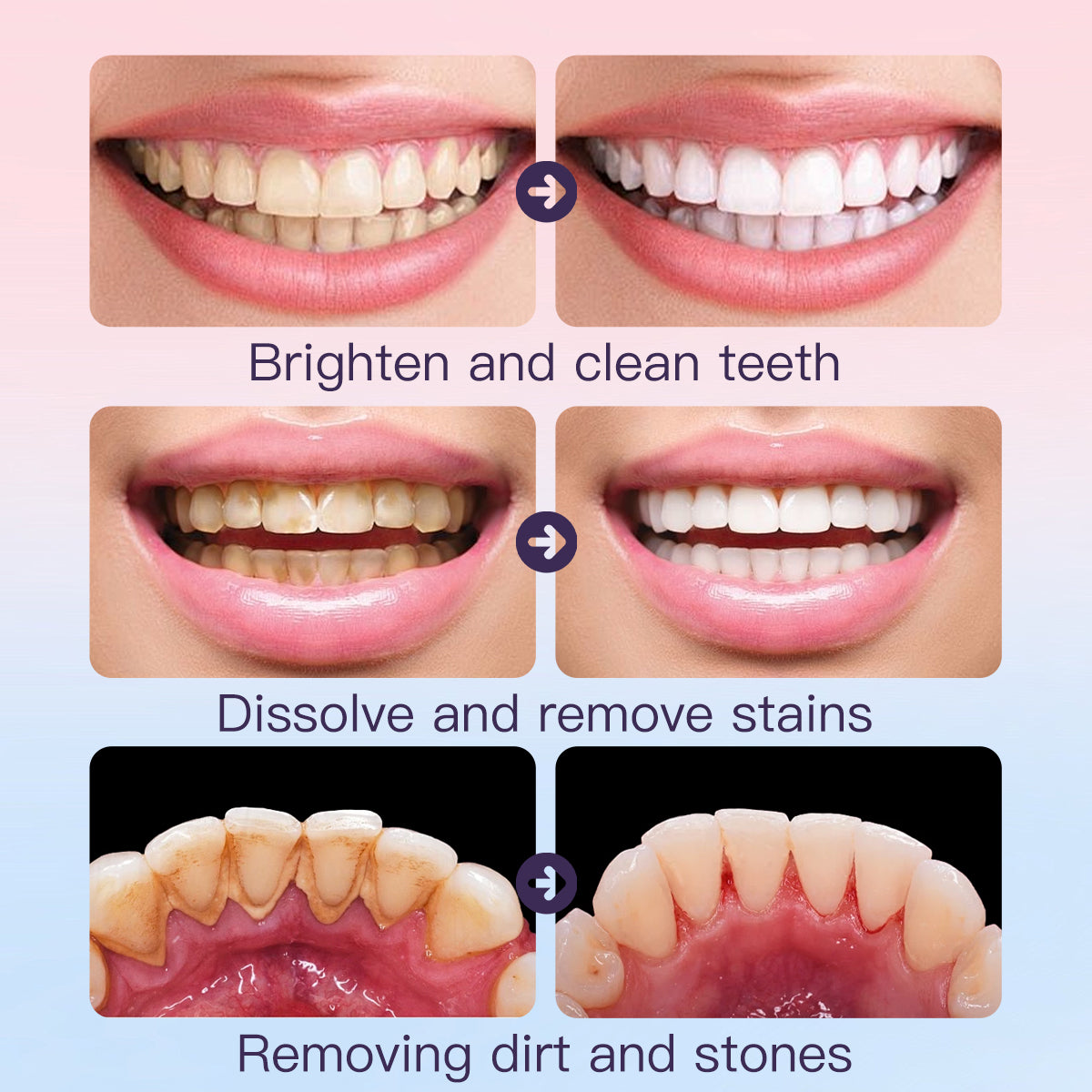 NIACINAMIDE POLISHING TOOTHPASTE - Brightening & Enamel-Safe Whitening Toothpaste for a Radiant Smile