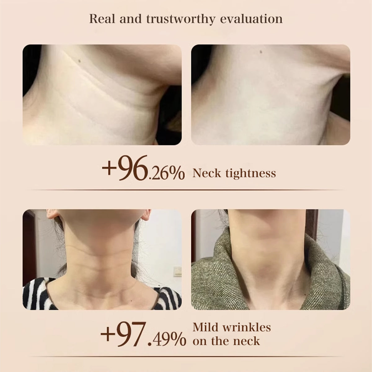 MOISTURIZING AND FIRMING NECK CREAM - Advanced Anti-Aging & Tightening Treatment for Neck and Décolletage